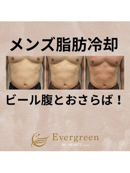 リハーツ(RE;heartz)/★－４℃脂肪冷却導入★