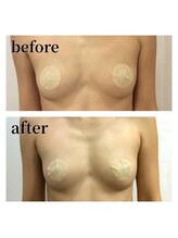 アンドボディ 横浜元町(&Body)/バストアップ/横浜元町