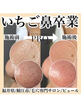 ピュール 鯖江店(PUR)/毛穴サロン/毛穴ケア/毛穴洗浄