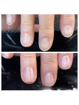 爪屋べっぴん堂/