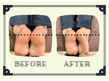 整体院プリュ/Before→ After［15］