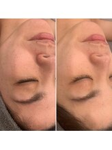 サロン アンド ビューティーエス(Salon&Beauty S)/毛穴洗浄♪