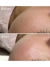 ホワイトワックス 京都四条烏丸(WHITE WAX)/艶肌★