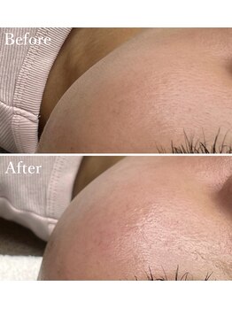 ホワイトワックス 京都四条烏丸(WHITE WAX)/艶肌★