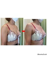 トロイカ(troika)/バストアップ　1回での効果★