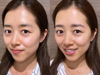 マリベル 表参道 外苑前(MARIBEL)の写真/【フェイシャルWAXでお肌をきれいに♪】シェアサロン内の落ち着いた空間でゆったり施術が受けられます★