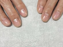 エメ(eme)/ハンドケアコース￥4,950