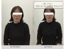 小顔×姿勢改善 KISHI BEAUTY SALON/【小顔矯正】