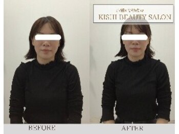 小顔×姿勢改善 KISHI BEAUTY SALON/【小顔矯正】