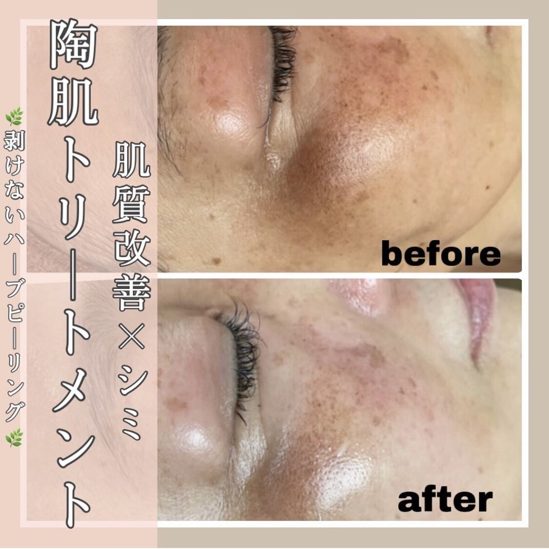 シエスティ｜ホットペッパービューティー