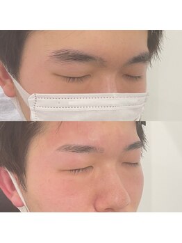眉毛の王様 神戸三宮店/お客様の施術例【神戸/三ノ宮】