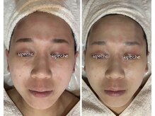 サロン ド モモ(salon de momo)/一回の効果で