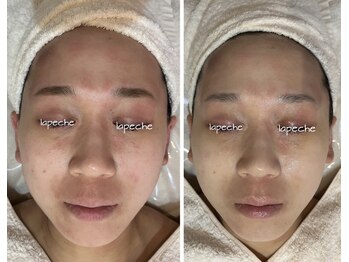 サロン ド モモ(salon de momo)/一回の効果で