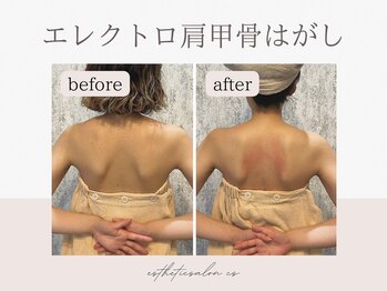 オートクチュール エステティックサロン シーズ/肩甲骨剥がし×ほぐし