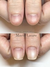 マリーロール 淀屋橋本店(Marie Laure)/自爪育成/深爪矯正/ネイルケア
