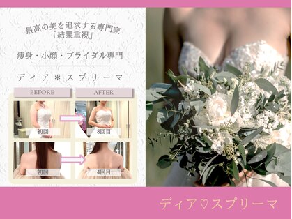 ディア スプリーマの写真