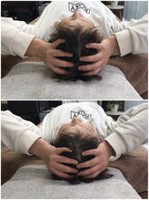 カルペード 中百舌鳥/なかもず院(Carpe D.)/施術後の変化