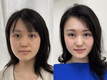 ウル 新宿代々木店(ULU)/こんなに透明感が出るなんて！