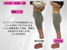 ビジリンヌ/反り腰　巻き肩　姿勢