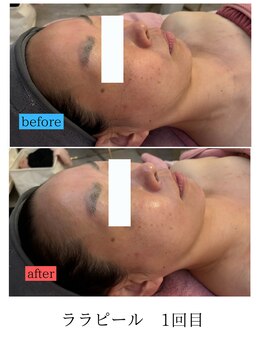 ユフラ(Juhla)/ララピール