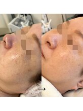 エステドブルー(Este de Bleu)/ビフォーアフター