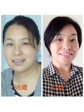 ハナノ整体院/小顔整体で若々しいお肌へ