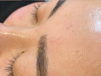 アネラアイラッシュ(Anela eyelash)/