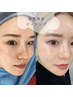 韓国美容外科と提携◎ここでしかできない幹細胞ゴールドピーリング！フル工程