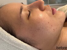 サロン ド エメ(salon de aimer)/【Before】くすみがちなお肌にも