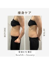 ククルヘルスビューティー(CUCURU health×beauty)/大人気痩身ケアでスッキリ！