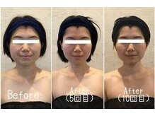 小顔フェイスラボ 千葉店(小顔Face Labo.)の雰囲気（5回目からは無料で小顔矯正をプレゼント！骨格から小顔に改善♪）