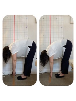 ハンズ治療院 東中野院/「姿勢矯正の症例」