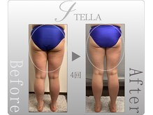 ステラ(STELLA)/下半身プレミアム4回の効果