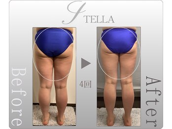 ステラ(STELLA)/下半身プレミアム4回の効果