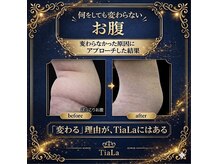 メンズアンドレディース エステティックサロン ティアラ(TiaLa)