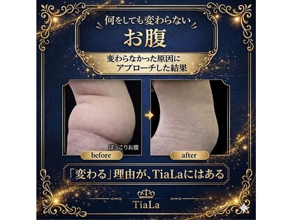 メンズアンドレディース エステティックサロン ティアラ(TiaLa)の写真