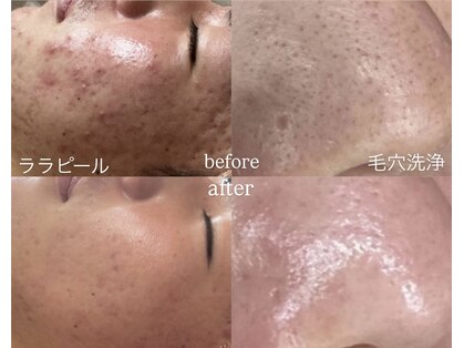 タイズレリーフ(TIES RELIEF)の写真