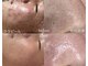 タイズレリーフ(TIES RELIEF)の写真
