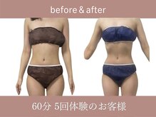 ソウ(SOU)の雰囲気（セルライトゼロでお腹周り痩身もお任せ！究極ボディへダイエット）