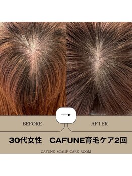 カフネスカルプケアルーム(CAFUNE SCALP CARE ROOM)/