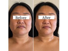 ニコリ(nicori)の雰囲気(エラ張り食いしばり改善!独自のオールハンド施術で小顔矯正♪)