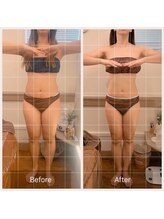 カルナ(carna)/《3か月計6回》2週間に1回