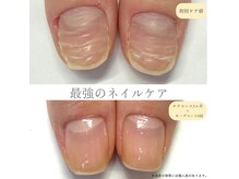 サロン スミレ(salon sumire)の雰囲気（深爪・平爪などのコンプレックス、爪は変わらないと諦めている方）