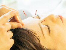 鍼灸サロン 道の雰囲気（覚王山で高品質な美容鍼◎心地良く効果も実感したい人へ）