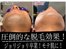 サロンチョコ(salon choco)