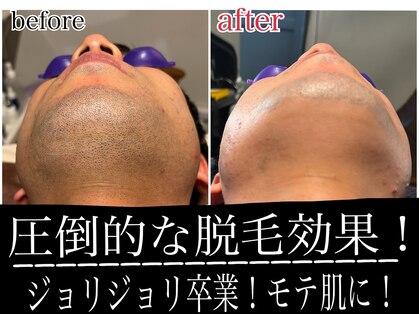 サロンチョコ(salon choco)の写真