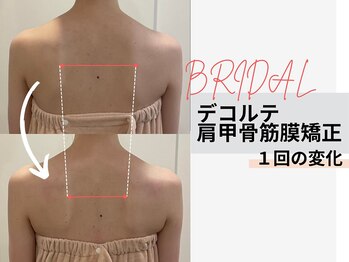 ミルズ 天神店(MillS)/デコルテ肩甲骨矯正