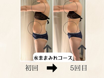 ヨサパーク シアー(YOSA PARK sheer)の写真