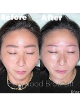 ドール アイラッシュ(D'or EYELASH)/HBL ハリウッドブロウリフト