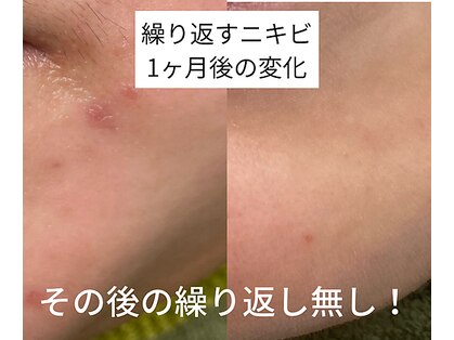 サイ(Sai)の写真